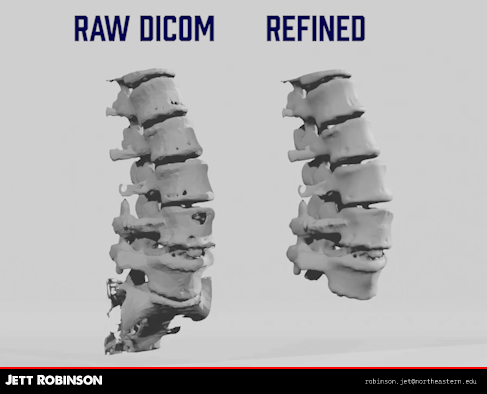 Spine DICOM preview